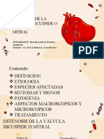 Estenosis de La Válvula Bicuspide O Mitral