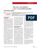 Aspects Eeg de L'encephalopathie Metabolique