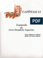 Capítulo 13 - Expansão do Arco Dentário Superior