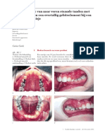 Nummer1 - Tandheelkundige - Casm Orthodontie M1 Combinatie Van Naar Voren Staande Tanden Met Impacties en Een Overtallig Gebitselement