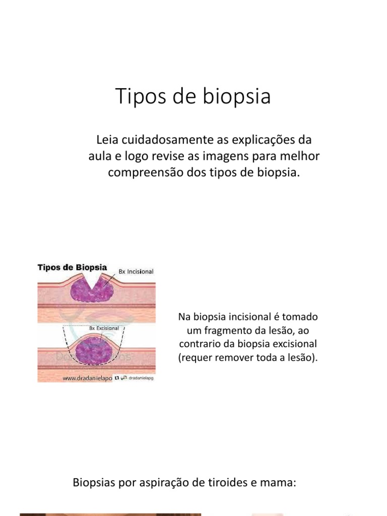 Tipos de Biópsia: Incisional e Excisional | PDF | Bem-estar | Ciências ...