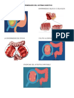 Enfermedades Del Sistema Digestivo