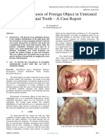 Incidental Diagnosis of Foreign Object in Untreated Rootcanal Tooth - A Case Report