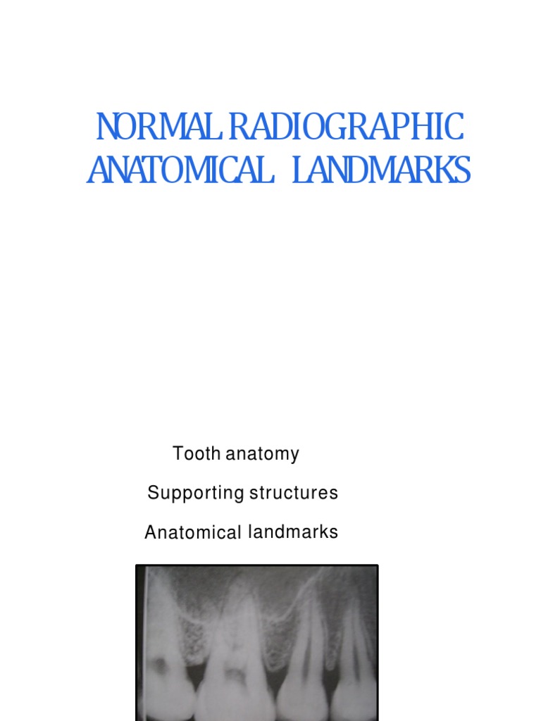 Radiographic Landmarks of Maxilla & Mandible | PDF | Dentistry Branches ...