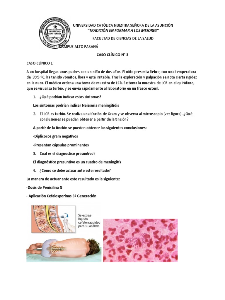 Un caso de meningitis bacteriana aguda | PDF
