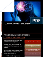 Convulsiones - Epilepsia Si y No