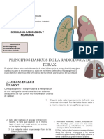 Seminario de Neumonia