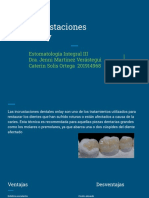 Onlay: Restauración dental que abarca una o dos cúspides