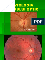 PATOLOGIA NERVULUI OPTIC (1)