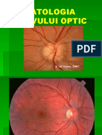 Patologia Nervului Optic