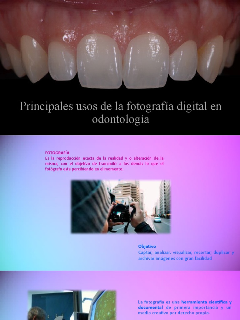 Usos de la Fotografía Digital en Odontología | PDF | Odontología