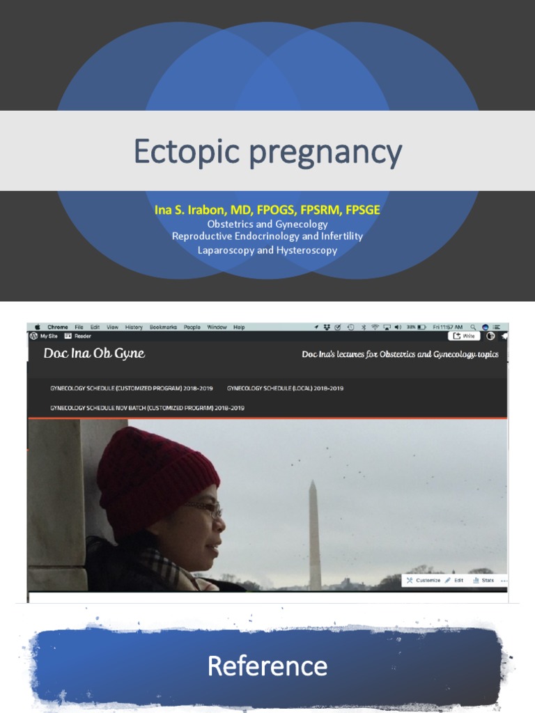Ectopic Pregnancy | PDF | Public Health | Medical Specialties
