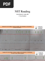 NST Reading: Kevin Marcial I. Aralar, MD 1 Year Resident