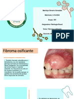 Fibroma Osificante