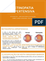 Retinopatia hipertensiva: complicações e tratamento