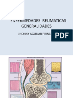 Enfermedades Reumaticas Generalidades: Jhonny Aguilar Principe