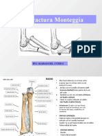 Luxofractura Monteggia: Ipg: Mariangel Oviedo