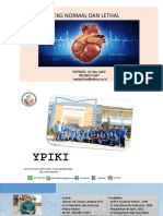 Ekg Normal Dan Lethal: Ropiqoh, M. Kep, SPKV 081285711647 Ropiqohnaz@yahoo - Co.id