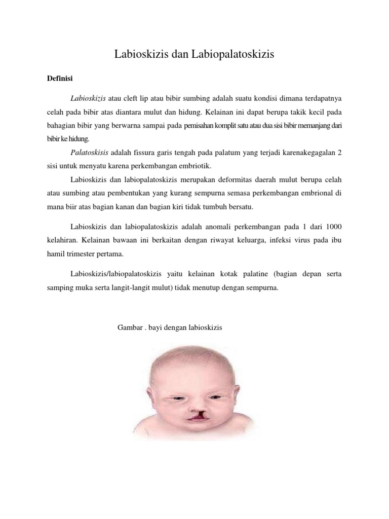 Labioskizis Dan Labiopalatoskizis | PDF | Kajian Bahasa Asing | Sains ...