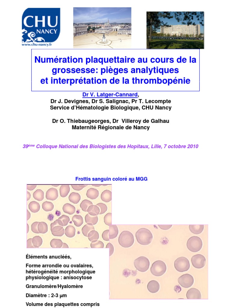 99,5 % Poudre De Zinc Ultra Fine, 6 µm, En Forme De Plaque/flaky