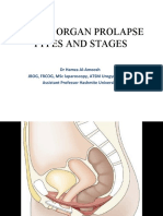 Pelvic Organ Prolapse Types and Stages