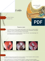 Tumores Del Oído: Dra. Maria Valladares Christopher Cruz