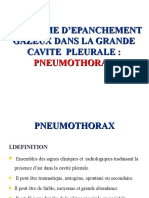 Syndrome D'Epanchement Gazeux Dans La Grande Cavite Pleurale: Pneumothorax