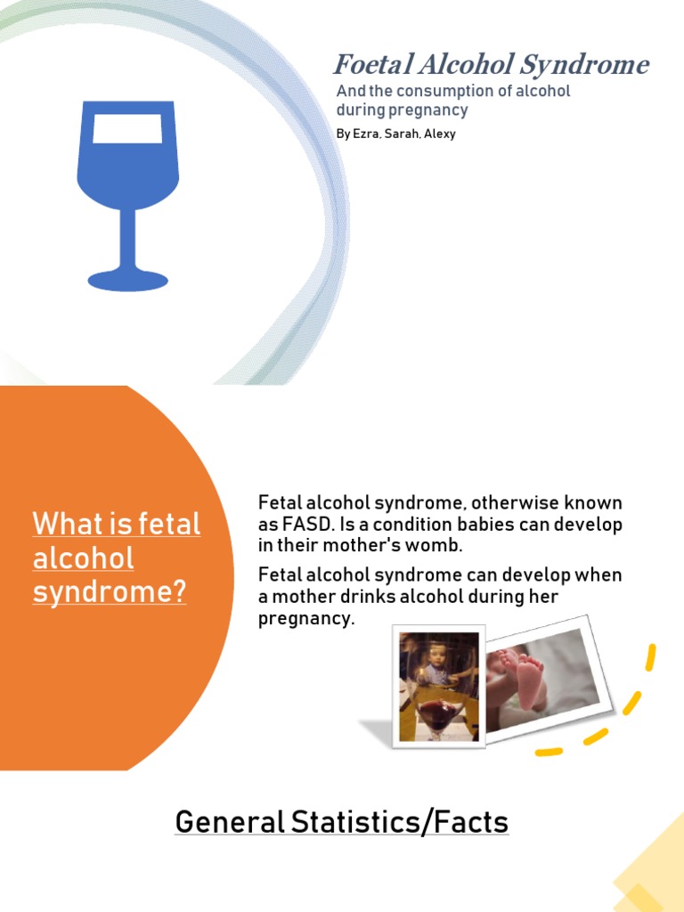 Effects of Alcohol Consumption During Pregnancy Fetal Alcohol Syndrome PDF Fetus Clinical