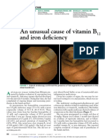 An Unusual Cause of Vitamin B and Iron Deficiency: The Clinical Picture