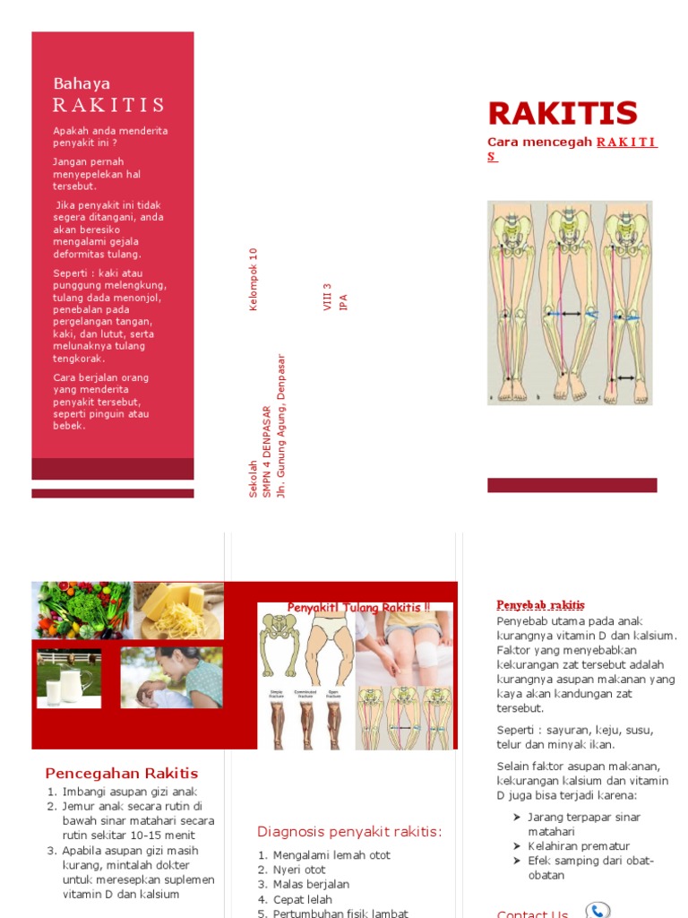 Pencegahan dan Gejala Rakitis Anak | PDF