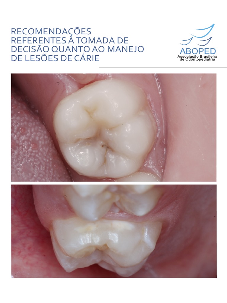 manejo-de-les-es-de-c-rie-dent-ria-pdf-esmalte-dent-rio-dente