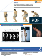 Espondiloartritis: características clave de un grupo heterogéneo de enfermedades reumáticas