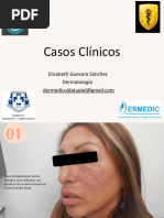 Casos Clínicos: Elizabeth Guevara Sánchez Dermatología