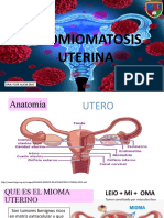 Leiomiomatosis