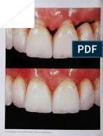 The Diagnostic Template A KeyElement To The ComprehensiveEsthetic Treatment Concept