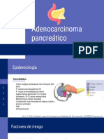 Adenocarcinoma Pancreático: Slidesmania.C OM