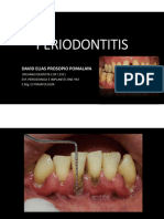 Clase 2 Periodontitis Crónica