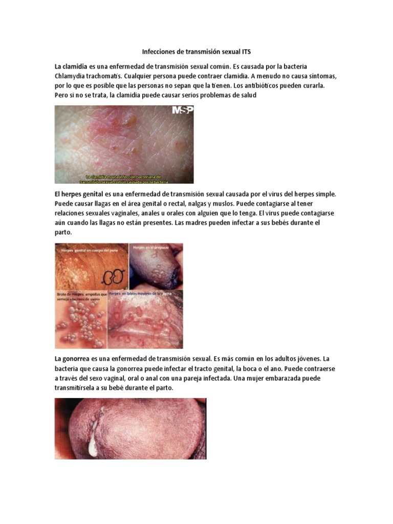 Infecciones de Transmisión Sexual ITS | PDF | Infección transmitida  sexualmente | VIH / SIDA, image size:768x1024