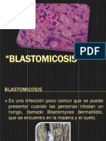 Blastomicosis