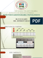Electrocardiograma Patologico