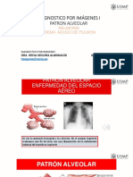 Diagnostico Por Imágenes I Patron Alveolar: Neumonia Edema Agudo de Pulmon