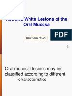 Red and White Lesions of The Oral Mucosa: DR - Wisam Rasool