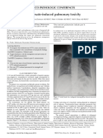 Methotrexate-Induced Pulmonary Toxicity