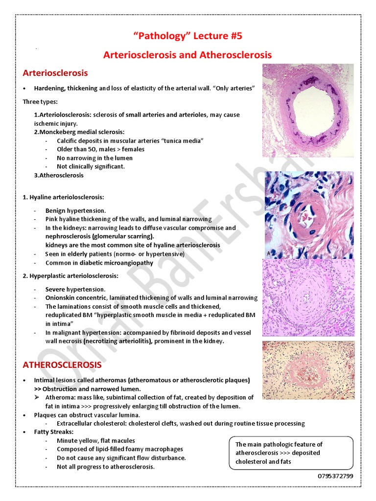 Atherosclerosis Histology Overview | PDF | Atherosclerosis | Atheroma