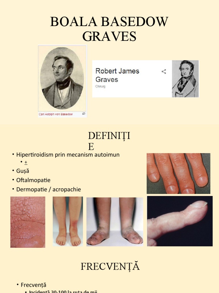 Boala Basedow Graves | PDF