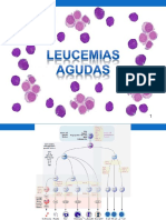 09 - Leucemias Agudas