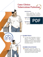 Caso Clinico Tuberculose - SAC