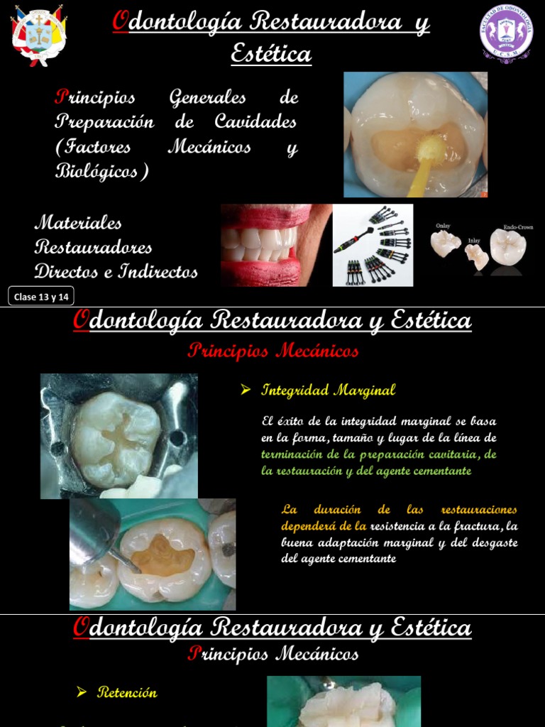 9-cariologia-teoria-clase-13-y-14-principios-de-preparacion-cavitaria