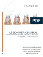 Lesion Periodontal PDF