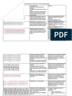 Arritmias - Caracteristicas e Tratamento PDF